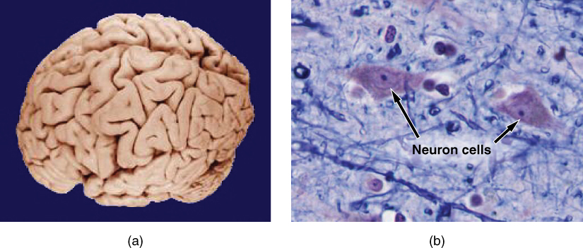 Side-by-side image of gross anatomy (brain) and microscopic anatomy (nerve cells from the brain)