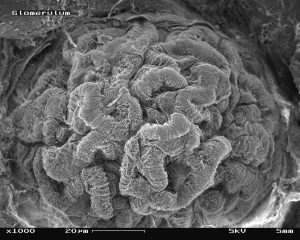 scanning electron micrograph showing glomerulus of mouse, magnified 1000 times