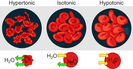 Illustration of red blood cells in hypertonic, isotonic, and hypotonic solutions with water movement depictions.