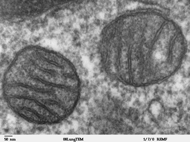 Transmission electron micrograph of two mitochondria showing internal membrane folds.