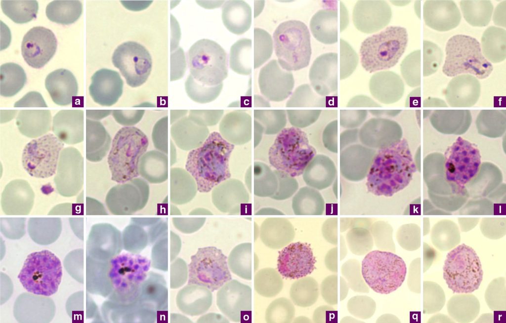 Grid of eighteen microscopic images showing various blood cells, labeled from "a" to "r."